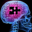 [Study] Could A Unique Protein Reduce The Development Of Alzheimer’s?